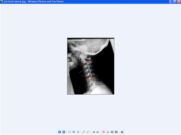 Patient File Tab Open
