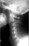 Patient File Tab Xray