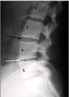 Patient File Tab Xray Marked
